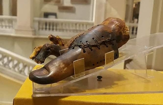 Protesi e chirurgia dell'antico Egitto