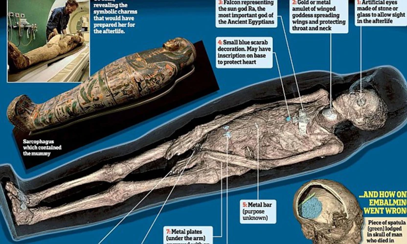 La precisione del gancio: come gli antichi egizi rimuovevano il cervello