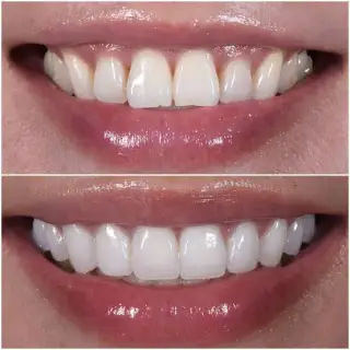 Dental Implants & Cairo Day Tour