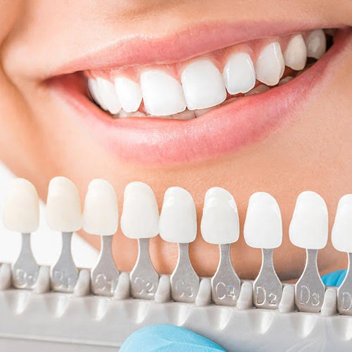 The Ultimate Guide to Teeth Whitening with Cairo Attractions