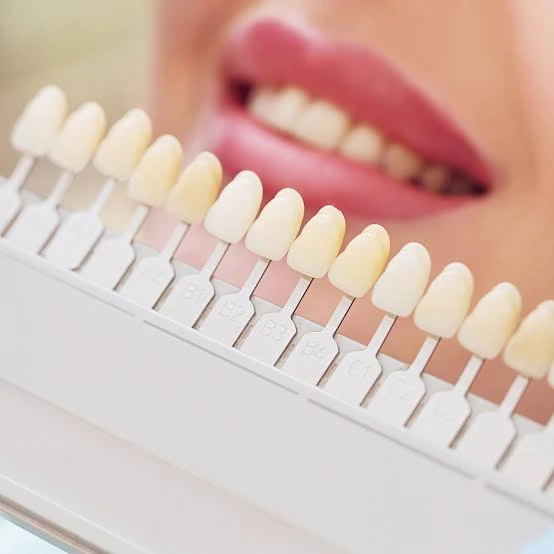 The Ultimate Guide to Teeth Whitening with Day Tour to the Religious Complex in Cairo