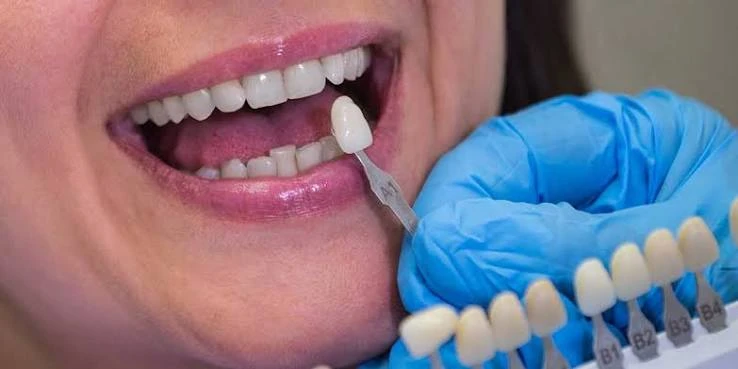 All-on-6 Dental Implant with fixed zirconia teeth & Day Tour to the Hanging Church