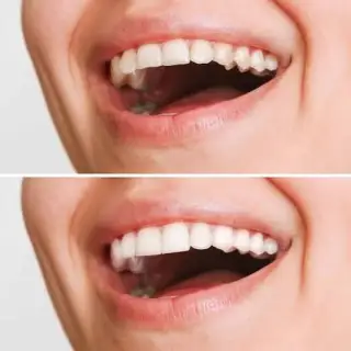 All-on-4 Dental Implants with Day Tour to the Hanging Church
