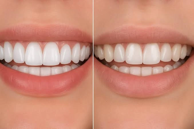 Dental Implants with Day Tour to the Hanging Church