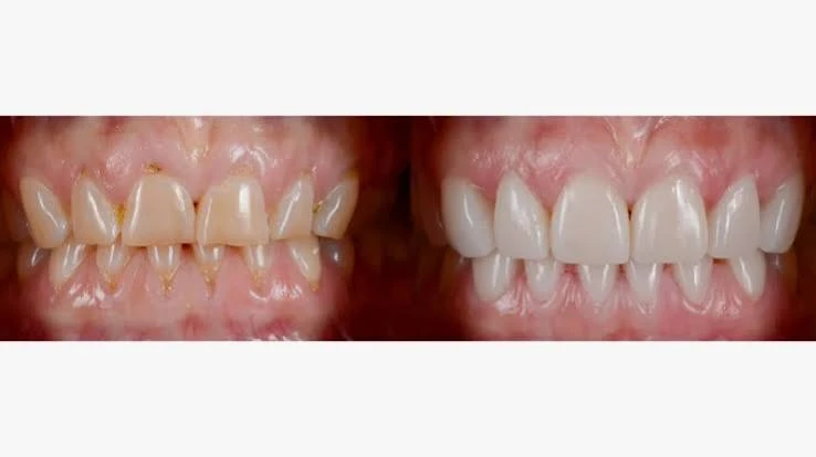 Dental Implants with Day Tour to the Hanging Church