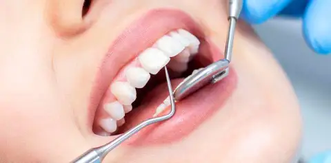 8 Veneers Program & Luxor Day Tour