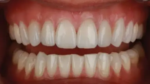 Implants dentaires avec une visite d'une journée à Alexandrie