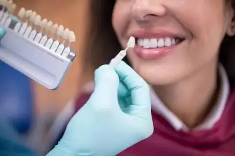 Implants dentaires All-on-4 avec visite d'une journée du complexe religieux au Caire